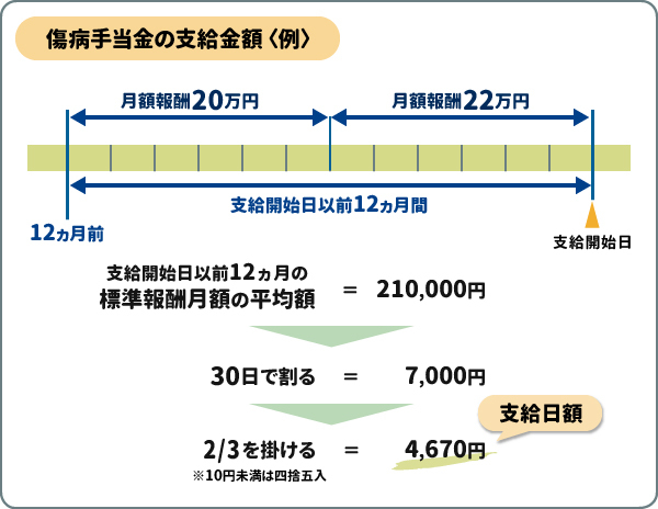 傷病手当金の支給金額（例）